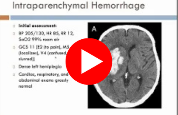 Webinar Recordings Pic of Video link